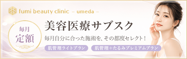 サブスクリプション