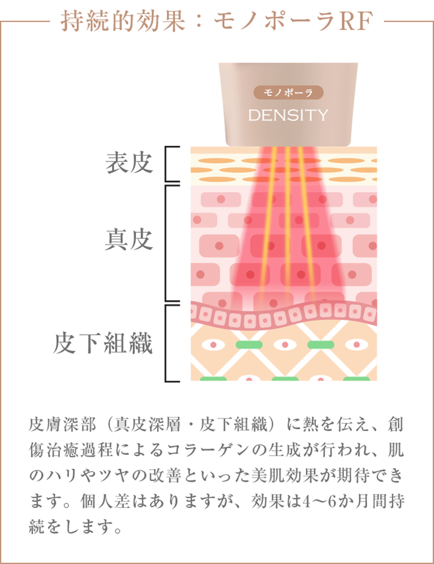 皮膚深部（真皮深層・皮下組織）に熱を伝え、創傷治癒過程によるコラーゲンの生成が行われ、肌のハリやツヤの改善といった美肌効果が期待できます。個人差はありますが、効果は4～6か月間持続をします。