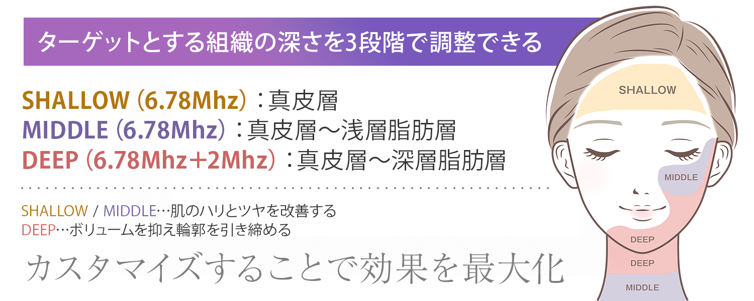 XERFの3つのモード