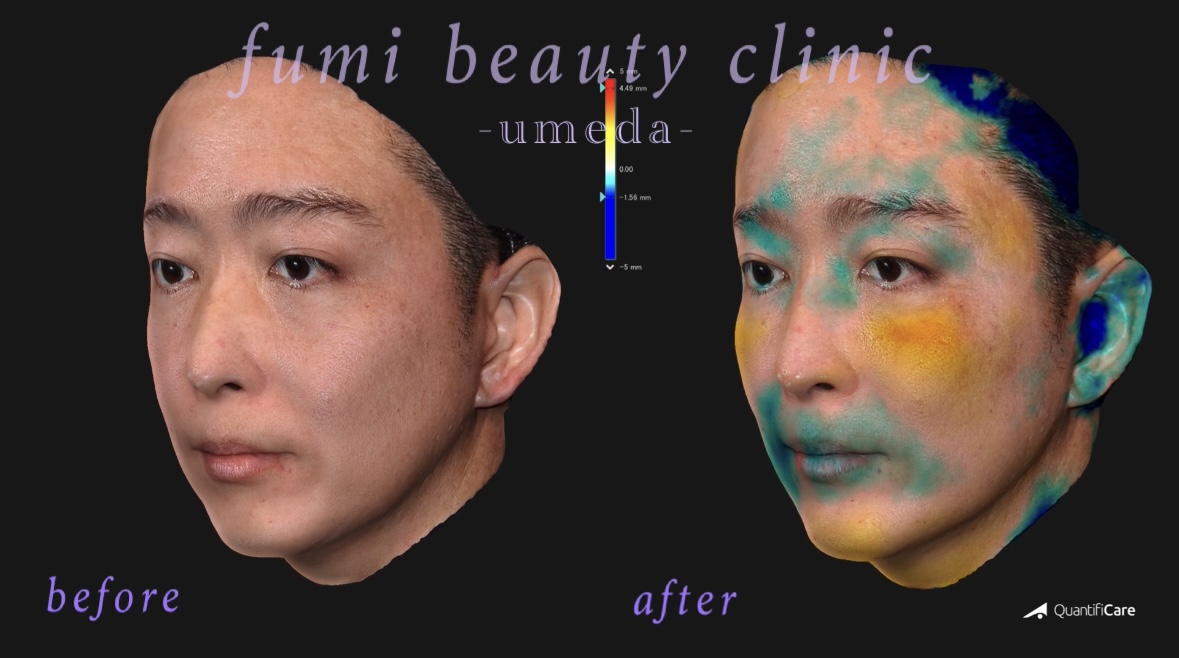 症例写真