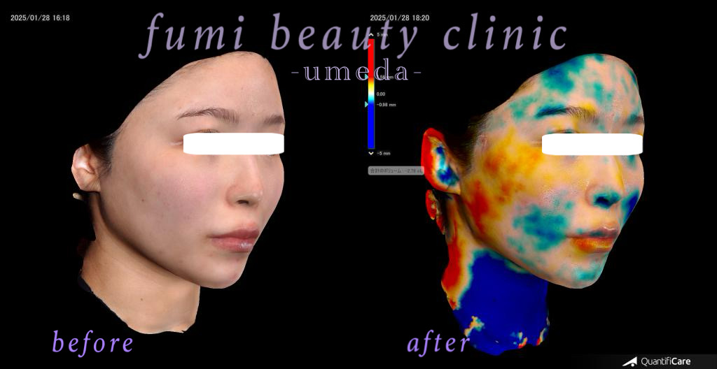 症例写真